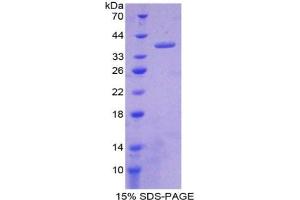 SDS-PAGE analysis of Rat Nesfatin 1 Protein. (NUCB2 蛋白)