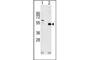 Image no. 1 for anti-TNF Receptor-Associated Factor 2 (TRAF2) (C-Term) antibody (ABIN360166) (TRAF2 抗体  (C-Term))