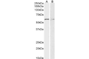 ABIN5539533 (2µg/ml) staining of HeLa (A) and K562 (B) lysates (35µg protein in RIPA buffer). (GPC1 抗体  (Internal Region))
