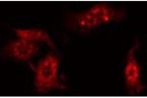 ABIN6274855 staining HeLa by IF/ICC. (Apolipoprotein F 抗体  (C-Term))