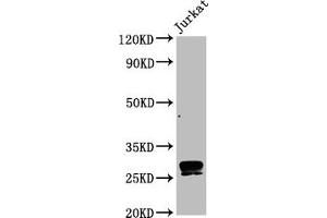 Western Blot Positive WB detected in Jurkat whole cell lysate All lanes CD99 antibody at 0. (Recombinant CD99 抗体)