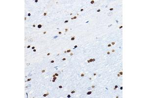 Immunohistochemistry of paraffin-embedded mouse brain using SOX10 Rabbit pAb (ABIN7270568) at dilution of 1:100 (40x lens). (SOX10 抗体  (AA 200-300))
