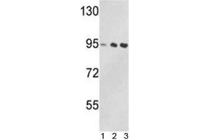 Western blot analysis of VCP antibody and 1) Jurkat, 2) 293, and 3) MDA-MB231 lysate. (VCP 抗体  (AA 726-755))