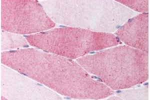 Human Skeletal Muscle (formalin-fixed, paraffin-embedded) stained with FBN1 antibody ABIN214104 at 5 ug/ml followed by biotinylated goat anti-rabbit IgG secondary antibody ABIN481713, alkaline phosphatase-streptavidin and chromogen. (Fibrillin 1 抗体  (N-Term))