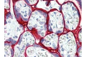 Human Placenta (formalin-fixed, paraffin-embedded) stained with SDC1at 15 µg/ml followed by biotinylated goat anti-rabbit IgG secondary antibody, alkaline phosphatase-streptavidin and chromogen. (Syndecan 1 抗体  (AA 18-218))
