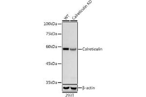 Western blot analysis of extracts from wild type (WT) and PD-1/CD279 knockdown (KD) 293T cells, using PD-1/CD279 antibody (ABIN7266042) at 1:1000 dilution. (Calreticulin 抗体)