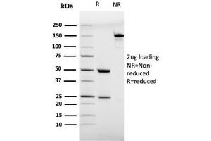 SDS-PAGE Analysis Purified CD28 Mouse Monoclonal Antibody (C28/75). (CD28 抗体)