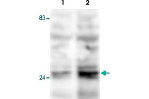 Western blot was performed on whole cell lysates from mouse fibroblasts (Lane 1, NIH/3T3) and embryonic stem cells (Lane 2, E14Tg2a) with Fkbp3 polyclonal antibody , diluted 1 : 500 in BSA/PBS-Tween. (FKBP3 抗体)