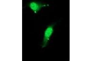 Image no. 3 for anti-Cystatin C (CST3) antibody (ABIN1497755) (CST3 抗体)