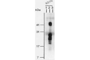 Western Blotting (WB) image for anti-Heparin-Binding EGF-Like Growth Factor (HBEGF) (Bound), (EGF Like Domain), (Soluble) antibody (ABIN3201018) (HBEGF 抗体  (Bound, EGF Like Domain, Soluble))