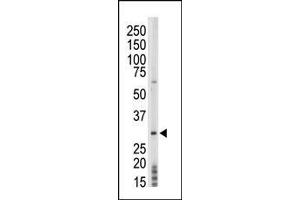 The anti-PRPK Pab (ABIN392682 and ABIN2842173) is used in Western blot to detect PRPK in mouse thymus tissue lysate. (TP53RK 抗体  (AA 220-249))