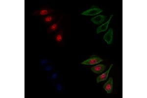 ABIN6263168 and ABIN6272598 staining Hela cells by IF/ICC.