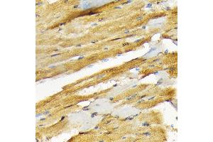Immunohistochemistry of paraffin-embedded rat heart using COPS3 Rabbit mAb (ABIN7266498) at dilution of 1:100 (40x lens). (COPS3 抗体)