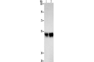 Western blot analysis of Hela cells A431 cells using ZFYVE19 Polyclonal Antibody at dilution of 1:500 (ZFYVE19 抗体)