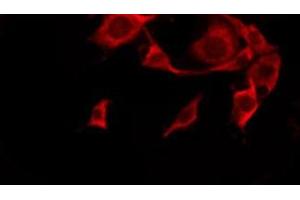 ABIN6276241 staining HeLa by IF/ICC. (OR10G4 抗体  (C-Term))
