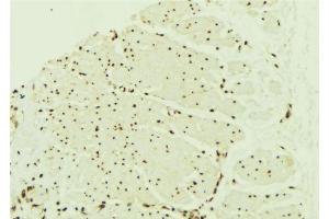 ABIN6268848 at 1/100 staining Mouse muscle tissue by IHC-P. (PPARA 抗体  (N-Term))