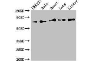 Western Blot Positive WB detected in: HEK293 whole cell lysate, Hela whole cell lysate, Mouse heart tissue, Mouse lung tissue, Mouse kidney tissue All lanes: FOXK1 antibody at 2. (Foxk1 抗体  (AA 621-730))