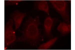 Image no. 1 for anti-Neurofibromin 2 (NF2) (pSer518) antibody (ABIN197028) (Merlin 抗体  (pSer518))