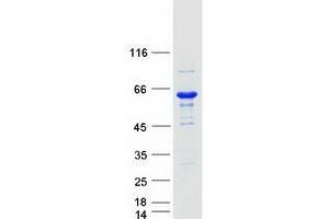 Western Blotting (WB) image for Glucokinase (Hexokinase 4) (GCK) (Transcript Variant 2) protein (Myc-DYKDDDDK Tag) (ABIN2721958)