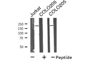 Western blot analysis of extracts from Jurkat/COLO205 cells, using MRCKa antibody. (CDC42BPA 抗体  (Internal Region))