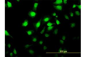 Immunofluorescence of monoclonal antibody to MKNK2 on HeLa cell. (MKNK2 抗体  (AA 1-158))