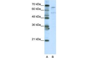Western Blotting (WB) image for anti-TAF6-Like RNA Polymerase II, P300/CBP-Associated Factor (PCAF)-Associated Factor, 65kDa (TAF6L) antibody (ABIN2461793) (TAF6L 抗体)