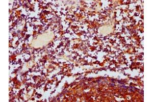 IHC image of ABIN7150474 diluted at 1:400 and staining in paraffin-embedded human lymph node tissue performed on a Leica BondTM system. (POLRMT 抗体  (AA 282-405))