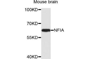 Western blot analysis of extracts of mouse brain cells, using NFIA antibody. (NFIA 抗体)