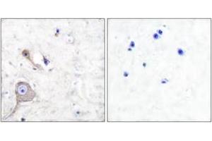 Immunohistochemistry analysis of paraffin-embedded human brain tissue, using S100 A1 Antibody. (S100A1 抗体  (AA 10-59))