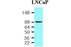 Western blot analysis: Cell lysates of LNCaP(30ug) were resolved by SDS-PAGE, transferred to NC membrane and probed with anti-human PSMA (1:1,000). (PSMA 抗体)