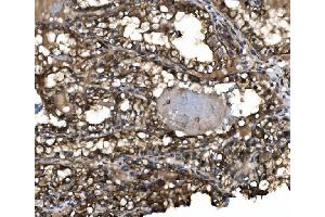 IHC analysis of Claudin 3/CLDN3 using anti-Claudin 3/CLDN3 antibody (ABIN7599626). (Claudin 3 抗体  (AA 101-220))