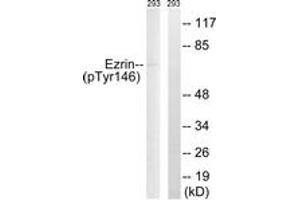 Western blot analysis of extracts from 293 cells treated with UV 15', using Ezrin (Phospho-Tyr146) Antibody. (Ezrin 抗体  (pTyr146))