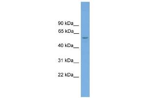 WB Suggested Anti-Toe1 Antibody Titration: 0. (TOE1 抗体  (Middle Region))