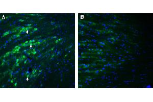 Expression of PACC1 in mouse reticular thalamic nucleus. (PACC1 (AA 95-110), (Extracellular) 抗体)