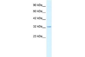 WB Suggested Anti-CLDN10 Antibody Titration:  2. (CLDN10 抗体  (C-Term))