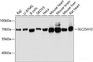 Western Blotting (WB) image for anti-Solute Carrier Family 25 (Mitochondrial Carrier, Aralar), Member 12 (Slc25a12) antibody (ABIN7255728)
