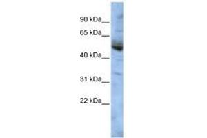 Image no. 1 for anti-COP9 Signalosome Subunit 4 (COPS4) (AA 143-192) antibody (ABIN6741398) (COPS4 抗体  (AA 143-192))