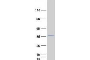 Ribosomal Protein L8 (RPL8) (Transcript Variant 2) protein (Myc-DYKDDDDK Tag)