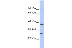 WB Suggested Anti-MYD88 Antibody Titration: 0. (MYD88 抗体  (N-Term))