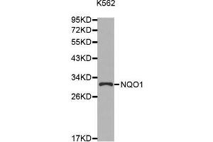 Western blot analysis of extracts of K562 cell line, using NQO1 antibody. (NQO1 抗体  (AA 1-274))
