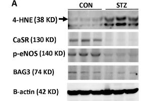 Western Blotting (WB) image for anti-4-Hydroxynonenal (HNE) antibody (ABIN873270)