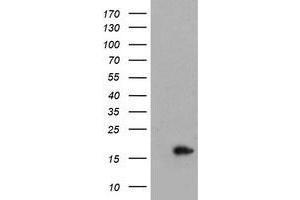 Image no. 1 for anti-Cellular Retinoic Acid Binding Protein 2 (CRABP2) antibody (ABIN1497621) (CRABP2 抗体)
