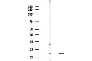 anti-Transmembrane Emp24 Domain Trafficking Protein 2 (TMED2) antibody