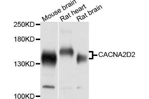 Western blot analysis of extracts of various cell lines, using CACNA2D2 antibody (ABIN5997344) at 1/1000 dilution.