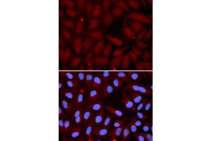 Immunofluorescence (IF) image for anti-Surfactant Protein C (SFTPC) antibody (ABIN1874760) (Surfactant Protein C 抗体)