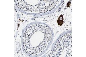Immunohistochemical staining of human testis with LOC203547 polyclonal antibody  shows strong cytoplasmic positivity in Leydig cells. (VMA21 抗体)