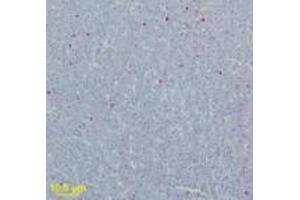 Image no. 1 for anti-West Nile Virus Matrix (WNV M) (AA 8-27) antibody (ABIN199989) (WNV M 抗体  (AA 8-27))