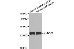 Western blot analysis of extracts of various cell lines, using MYBPC2 antibody. (MYBPC2 抗体)