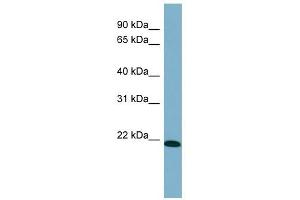 TIRAP antibody used at 1 ug/ml to detect target protein. (TIRAP 抗体)