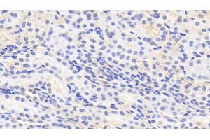 Detection of PURA in Human Kidney Tissue using Polyclonal Antibody to Purine Rich Element Binding Protein A (PURA)